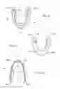 Fig. 17 - INTRA-ORAL LIGHT-THERAPY APPARATUSES AND METHODS FOR THEIR USE