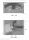 Fig. 77 - INTRA-ORAL LIGHT-THERAPY APPARATUSES AND METHODS FOR THEIR USE