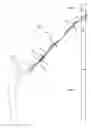 Fig. 01 - BELT PULLING EXERCISE APPARATUS