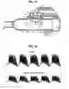 Fig. 44 - Smart oscillating positive expiratory pressure device