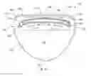 Fig. 37 - Golf club head