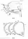 Fig. 07 - CG height adjustability by conformal weighting