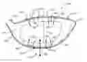 Fig. 01 - Golf club head