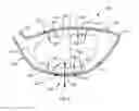 Fig. 08 - Golf club head