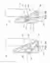 Fig. 02 - Golf club having an elastomer element for ball speed control