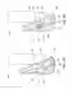 Fig. 04 - Golf club having an elastomer element for ball speed control