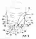 Fig. 04 - Whistle Mount Assembly