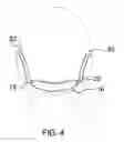 Fig. 05 - Whistle Mount Assembly