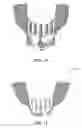 Fig. 09 - Mouthguard with lung exerciser
