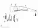 Fig. 72 - Processor-controlled sport boot binding