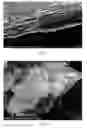 Fig. 02 - PARTICLES COMPRISING STACKED GRAPHENE LAYERS