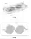 Fig. 18 - Microfluidic diagnostic assembly