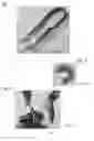 Fig. 02 - PUSH FITTING TUBING REMOVER