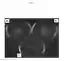 Fig. 02 - Antibodies against microorganisms and uses thereof