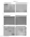 Fig. 07 - METHOD OF TREATING SYSTEMIC FIBROTIC DISORDERS USING AN IL-33/TNF BISPECIFIC ANTIBODY