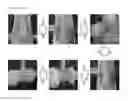 Fig. 08 - VISIBLE LIGHT-CURABLE WATER-SOLUBLE CHITOSAN DERIVATIVE, CHITOSAN HYDROGEL, AND PREPARATION METHOD THEREFOR