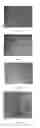 Fig. 02 - METHOD FOR PREPARING MESENCHYMAL STEM CELL PREPARATION BY USING ARTHROSCOPIC IRRIGATION SOLUTION