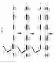 Fig. 02 - Omega amplification