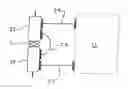 Fig. 01 - Umbilical method