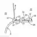 Fig. 01 - Device and method of applying a sealant around a structural adhesive to prevent corrosion