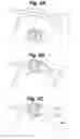 Fig. 06 - Tangle-resistant decorative lighting assembly
