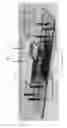 Fig. 02 - Determination of operability of a digital scanner with shearing interferometry