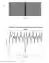 Fig. 08 - Determination of operability of a digital scanner with shearing interferometry
