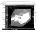 Fig. 01 - Facilitating transitioning between viewing native 2D and reconstructed 3D medical images