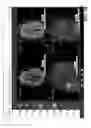 Fig. 09 - Facilitating transitioning between viewing native 2D and reconstructed 3D medical images