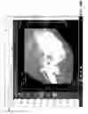 Fig. 22 - Facilitating transitioning between viewing native 2D and reconstructed 3D medical images
