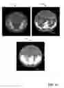 Fig. 28 - Facilitating transitioning between viewing native 2D and reconstructed 3D medical images