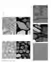 Fig. 08 - GLAND SEGMENTATION WITH DEEPLY-SUPERVISED MULTI-LEVEL DECONVOLUTION NETWORKS