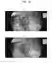 Fig. 10 - Image processing device, image processing method, medical imaging system