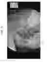 Fig. 11 - Image processing device, image processing method, medical imaging system