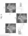 Fig. 15 - Image processing device, image processing method, medical imaging system