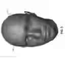 Fig. 06 - Head modeling for a therapeutic or diagnostic procedure