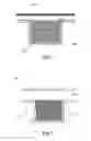 Fig. 02 - Sound-absorbing component and speaker module applying the sound-absorbing component