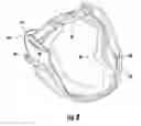 Fig. 09 - RETRACTABLE LEASH AND COLLAR OR HARNESS ASSEMBLY