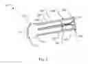 Fig. 04 - PORTABLE SMOKING APPARATUS
