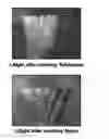 Fig. 01 - Polyketone Bristles And Toothbrush Comprising The Bristles