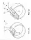 Fig. 03 - Fluorophore imaging devices, systems, and methods for an endoscopic procedure