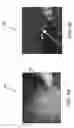 Fig. 05 - Fluorophore imaging devices, systems, and methods for an endoscopic procedure