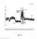 Fig. 07 - Reliable seizure detection with a parallelizable, multi-trajectory estimate of lyapunov exponents