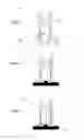 Fig. 02 - Device and method for measuring skin elasticity