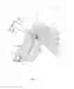 Fig. 11 - Integrated ligament strain measurement
