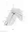 Fig. 12 - Integrated ligament strain measurement