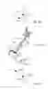 Fig. 08 - Intraoperative alignment assessment system and method