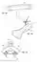 Fig. 09 - Intraoperative alignment assessment system and method