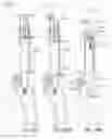 Fig. 158 - Intraoperative alignment assessment system and method