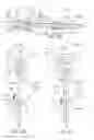 Fig. 22 - Intraoperative alignment assessment system and method
